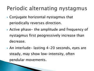  Conjugate horizontal nystagmus that
periodically reverses direction.
 Active phase- the amplitude and frequency of
nystagmus first peogressively increase than
decrease.
 An interlude- lasting 4-20 seconds, eyes are
steady, may show low-intensity, often
pendular movements.
 