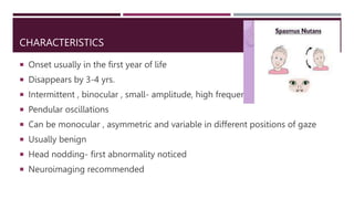 NYSTAGMUS In neurophthalmology by sreya c | PPTX