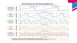 Frequency
Frequency is the no. of to and fro movement in one second.
Described as cycles/secs or Hertz(Hz)
Slow:1-2Hz
Medium:3-4Hz
Fast:5Hz or more
 
