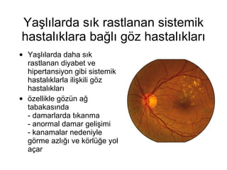 Yaşlılarda sık rastlanan sistemik hastalıklara bağlı göz hastalıkları Yaşlılarda daha sık rastlanan diyabet ve hipertansiyon gibi sistemik hastalıklarla ilişkili göz hastalıkları  özellikle gözün ağ tabakasında - damarlarda tıkanma - anormal damar gelişimi - kanamalar nedeniyle görme azlığı ve körlüğe yol açar  