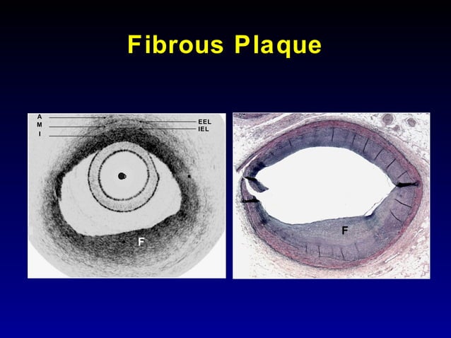 optical-coherence-tomography-jang-mgh-ppt