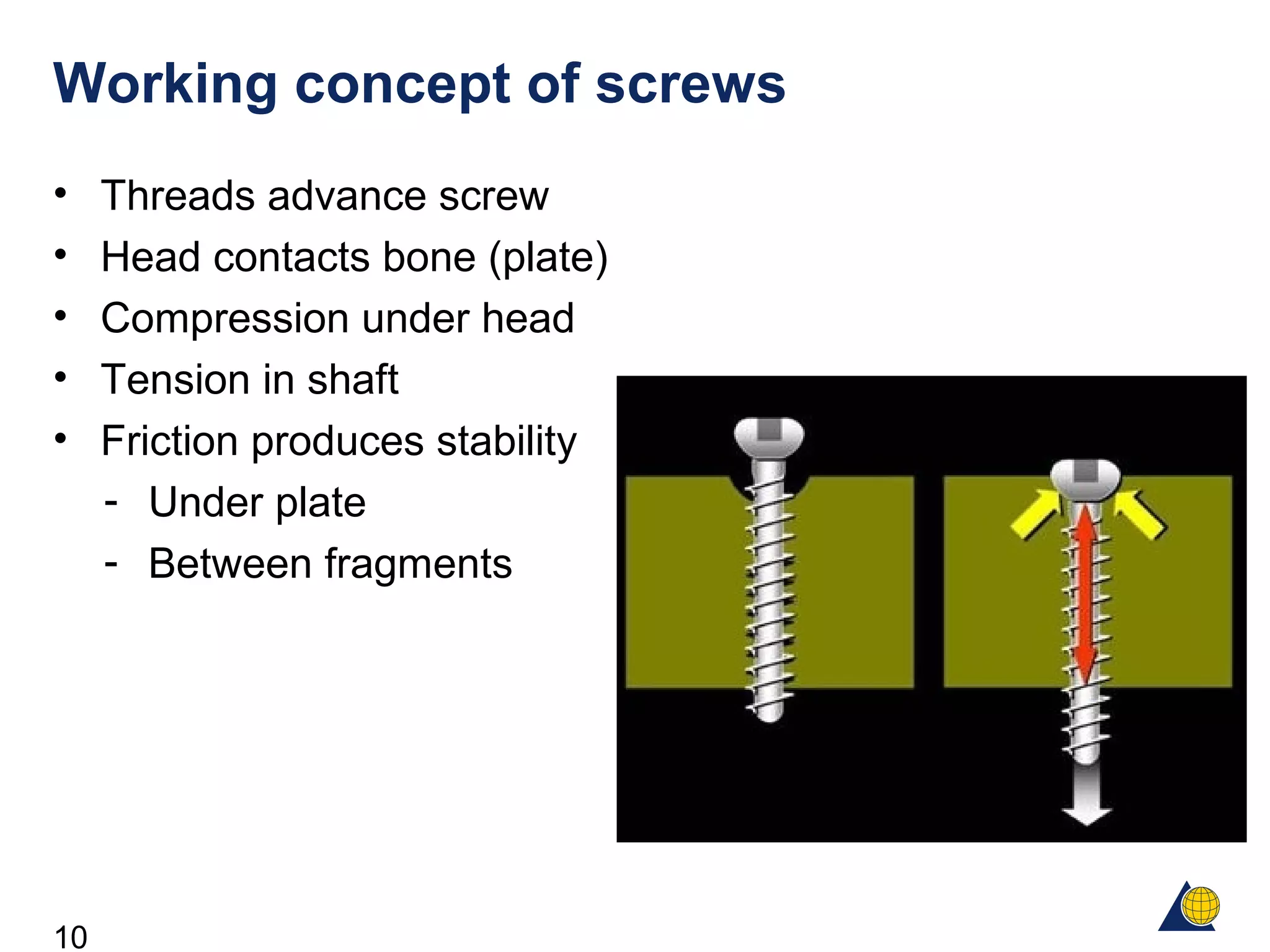10
Working concept of screws
• Threads advance screw
• Head contacts bone (plate)
• Compression under head
• Tension in shaft
• Friction produces stability
- Under plate
- Between fragments
 