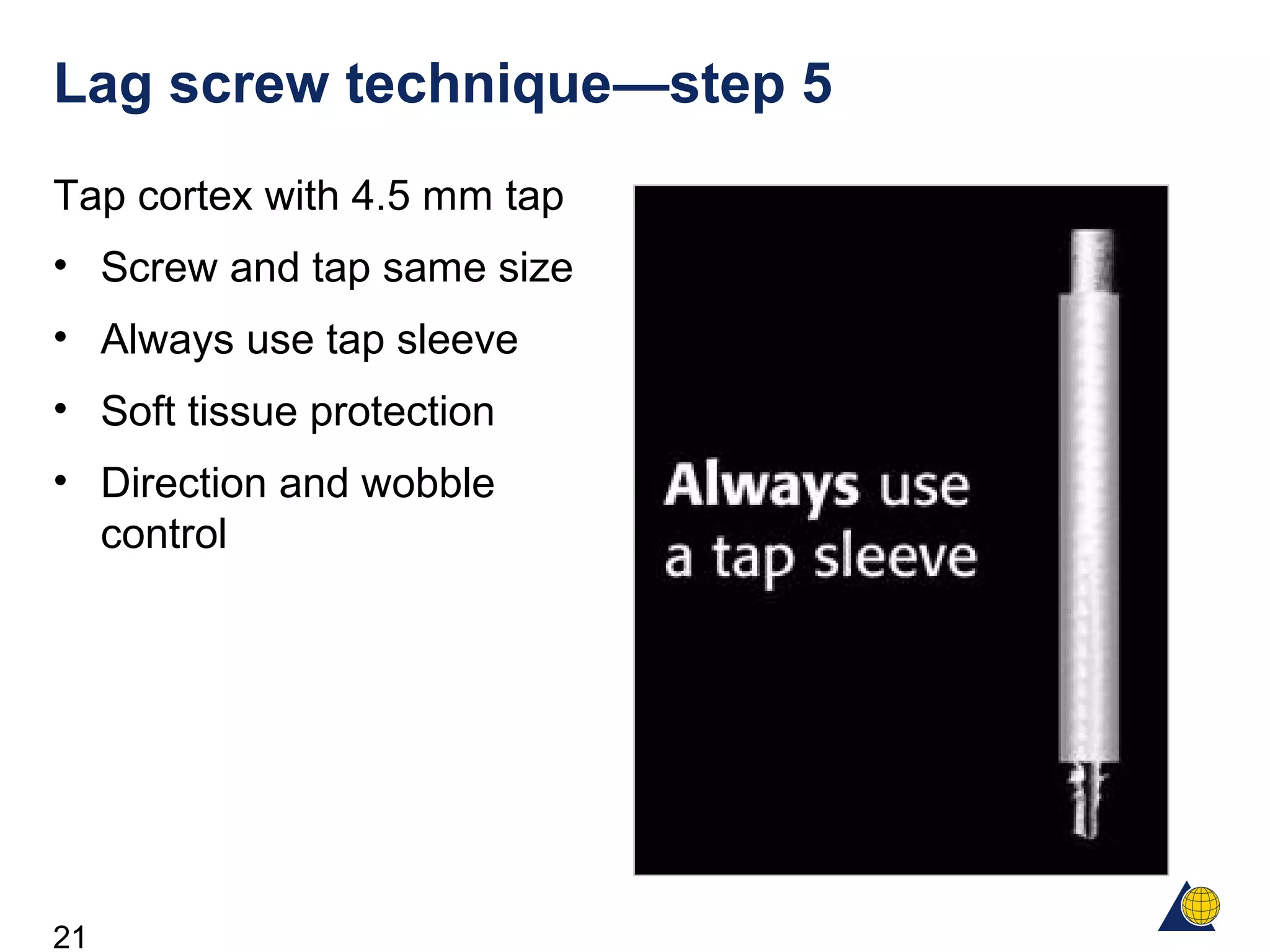 21
Lag screw technique—step 5
Tap cortex with 4.5 mm tap
• Screw and tap same size
• Always use tap sleeve
• Soft tissue protection
• Direction and wobble
control
 