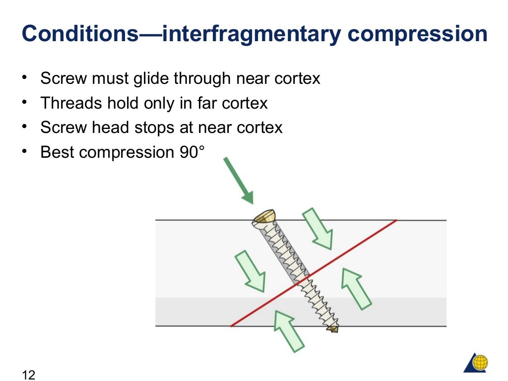 Design and function of surgical screws