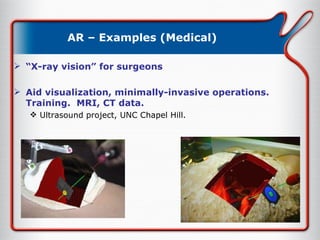 AR – Examples (Medical) “ X-ray vision” for surgeons Aid visualization, minimally-invasive operations.  Training.  MRI, CT data. Ultrasound project, UNC Chapel Hill. 