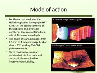 Mode of action
• For the current version of the
Heidelberg Retina Tomograph (HRT
II/HRT 3), the scan is centered on
the optic disc and a variable
number of slices are obtained at a
rate of 16/mm of scan depth.
• The depth of scanning ranges from
0.5 mm to 4 mm and image field of
view is 15°, yielding 384x384
picture elements.
• Three consecutive scans are
obtained within 2 seconds and
automatically combined to
improve reproducibility.
 