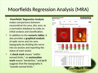Moorfields Regression Analysis (MRA)
• Moorfields' Regression Analysis
makes comparisons between
neuroretinal rim area, disc area, to
a normative database to make an
initial analysis and classification.
• In addition to the numeric tables, it
also provides a graphical analysis
of optic nerve and rim area
topography by dividing the nerve
into six sectors and reporting the
status of each sector.
• A check mark means "within
normal limits," an exclamation
mark means "borderline," and an X
suggests that the topography is
"outside normal limits."
 