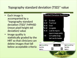Topography standard deviation (TSD)" value
• Each image is
accompanied by a
"topography standard
deviation (TSD)“/MPHSD
(mean pixel height std
deviation) value
• Image quality is
statistically graded by the
HRT so that clinicians can
delete images that fall
below acceptable criteria
 