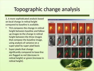 Topographic change analysis
3. A more sophisticated analysis based
on local change in retinal height
compared to baseline is available.
• TCA compares the change in retinal
height between baseline and follow-
up images to the change in retinal
height between the three images
that compose the baseline image,
using analysis of variance on a
super-pixel by super pixel basis
• Super pixels that change
significantly compared to base-line
are flagged as red (decrease in
retinal height) or green (increase in
retinal height).
 