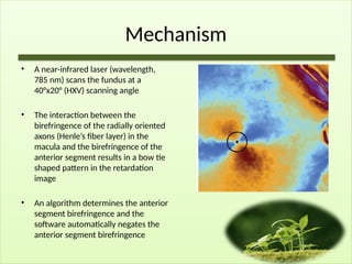 Mechanism
• A near-infrared laser (wavelength,
785 nm) scans the fundus at a
40°x20° (HXV) scanning angle
• The interaction between the
birefringence of the radially oriented
axons (Henle’s fiber layer) in the
macula and the birefringence of the
anterior segment results in a bow tie
shaped pattern in the retardation
image
• An algorithm determines the anterior
segment birefringence and the
software automatically negates the
anterior segment birefringence
 