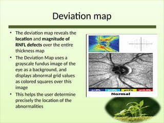 Deviation map
• The deviation map reveals the
location and magnitude of
RNFL defects over the entire
thickness map
• The Deviation Map uses a
grayscale fundus image of the
eye as a background, and
displays abnormal grid values
as colored squares over this
image
• This helps the user determine
precisely the location of the
abnormalities
 