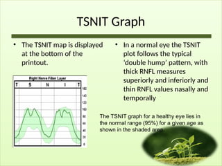 TSNIT Graph
• The TSNIT map is displayed
at the bottom of the
printout.
• In a normal eye the TSNIT
plot follows the typical
‘double hump’ pattern, with
thick RNFL measures
superiorly and inferiorly and
thin RNFL values nasally and
temporally
The TSNIT graph for a healthy eye lies in
the normal range (95%) for a given age as
shown in the shaded area.
 