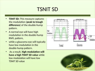 TSNIT SD
• TSNIT SD: This measure captures
the modulation (peak to trough
difference) of the double-hump
pattern.
• A normal eye will have high
modulation in the double-hump
RNFL pattern,
• while a glaucoma eye will typically
have low modulation in the
double-hump pattern.
• As a result, high modulation will
have a high TSNIT SD value while
low modulation will have low
TSNIT SD value
 
