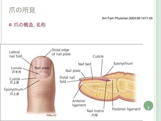 爪の所見
                    Am Fam Physician 2004;69:1417-24

   爪の構造, 名称




    爪半月


爪上皮


爪上皮



                       ...