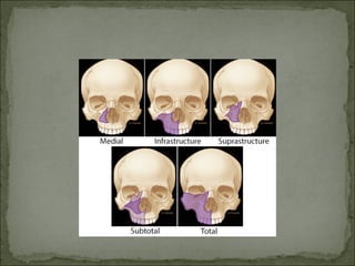 Oral Surgery oral cancer college ofdentistry | PDF