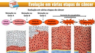 Evolução em várias etapas do câncer
Célula	
  
normal	
  
Proliferação	
  
aumentada	
  
Início	
  da	
  	
  
neoplasia	
  
Neoplasia	
  
progressiva	
  
Carcinoma	
   Metástase	
  
Mutação	
  no	
  
Gene	
  A	
  
Mutação	
  no	
  
Gene	
  B	
  
Mutação	
  no	
  
Gene	
  C	
   Aumento	
  de	
  aneuploidias	
  
cromossômicas	
  
Pode	
  incluir	
  mutações	
  em	
  genes	
  de	
  reparo	
  do	
  DNA	
  
Evolução	
  em	
  várias	
  etapas	
  do	
  câncer	
  
 