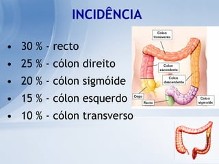 30 % - recto 25 % - cólon direito 20 % - cólon sigmóide 15 % - cólon esquerdo 10 % - cólon transverso INCIDÊNCIA 