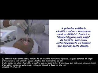 A primeira evidência
                                                             científica sobre a hanseníase
                                                              está na Bíblia! E Jesus é o
                                                              *dermatologista mais sábio*
                                                                 da história, pois curou
                                                             instantaneamente 10 homens
                                                               que sofriam desta doença.



E, entrando numa certa aldeia, saíram-lhe ao encontro dez homens leprosos, os quais pararam de longe;
E levantaram a voz, dizendo: Jesus, Mestre, tem misericórdia de nós.
E ele, vendo-os, disse-lhes: Ide, e mostrai-vos aos sacerdotes. E aconteceu que, indo eles, ficaram limpos.
E um deles, vendo que estava são, voltou glorificando a Deus em alta voz;
(LUCAS 17:12 A 15)
 