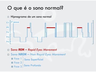 O que é o sono normal?
   Hipnograma de um sono normal




   Sono REM – Rapid Eyes Movement
   Sono NREM – Non Rapid Eyes Movement
       Fase 1 Sono Superficial
       Fase 2
       Fase 3 Sono Profundo
 