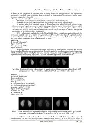 Medical Image Processing in Nuclear Medicine and Bone Arthroplasty
www.iosrjournals.org 104 | Page
b) based on the similarities of structures inside an image. In nuclear medicine images, the discontinuity
segmentation type finds more applications. This type depends on the detection of discontinuities or else, edges,
inside the image using a threshold.
The implementation of threshold helps in two main issues:
i) the removal of unnecessary information from the image (background activity) and,
ii) the appearance of details not easily detected. The edge detection uses the command edge.
In addition, a threshold is applied in order to detect edges above defined grey-scale intensity. Also,
different methods of edge detection can be applied according to the filter each of them utilises. The most useful
methods in nuclear medicine are the „Sobel‟, „Prewitt‟, „Roberts‟, „Canny‟ as well as „Laplacian of Gaussian'. It
is noted that the image is immediately transformed into a binary image and edges are detected. The general
function used for the edge detection is the following:
[BW] = edge (image, „method‟, threshold) Where [BW] is the new binary image produced, image is the
initial one; „method‟ refers to the method of edge detection and „threshold‟ to the threshold applied. In nuclear
medicine, the methods that find wide application are the sorbel, prewitt and canny. In the following example,
the canny method is applied in order to detect edges in an image.
Example 4
I = imread(„kidneys.jpg‟);
figure, imshow(I)
J = edge(I,'canny', 0.048);
figure, imshow(J)
Another application of segmentation in nuclear medicine is the use of gradient magnitude. The original
image is loaded. Then, the edge detection method of sobel is applied in accordance with a gradient magnitude
which gives higher regions with higher grey-scale intensity. Finally, the foreground details are highlighted and
segmented image of the kidneys is produced. The whole code for that procedure is described below.
Fig. 8. Edge detection (a) Original kidneys image, (b) edge detection with canny method and threshold 0.2667,
(c) edge detection with prewitt method and threshold 0.038. [(a) to (c) from left to right]
Example
I = imread('kidneys.jpg');
Figure, imshow(I)
hy = fspecial('sobel');
hx = hy';
Iy = imfilter(double(I), hy, 'replicate');
Ix = imfilter(double(I), hx, 'replicate');
gradmag = sqrt(Ix.^2 + Iy.^2);
figure, imshow(gradmag,[])
se = strel('disk', 20);
K = imopen(I, se);
figure, imshow(K).
Fig. 9. Gradient Magnitude process: (a) Original image, (b) image after implementation of filter and gradient
magnitude, (c) image after masking of foreground objects [(a) to (c) from left to right]
In the final image, the outline of the organs is depicted. The area inside the kidney has been separated
into larger parts with grey-scale intensity weighted and decided from the closest 20 pixels in a circular region. In
 