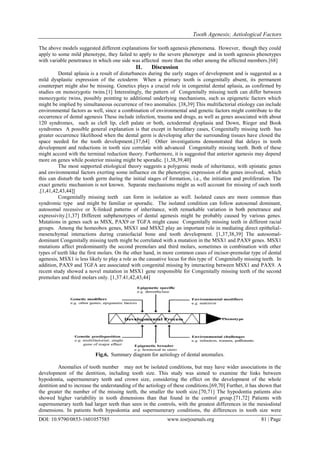 Tooth Agenesis; Aetiological Factors
DOI: 10.9790/0853-1601057585 www.iosrjournals.org 81 | Page
The above models suggested different explanations for tooth agenesis phenomena. However, though they could
apply to some mild phenotype, they failed to apply to the severe phenotype and in tooth agenesis phenotypes
with variable penetrance in which one side was affected more than the other among the affected members.[68]
II. Discussion
Dental aplasia is a result of disturbances during the early stages of development and is suggested as a
mild dysplastic expression of the ectoderm When a primary tooth is congenitally absent, its permanent
counterpart might also be missing. Genetics plays a crucial role in congenital dental aplasia, as confirmed by
studies on monozygotic twins.[1] Interestingly, the pattern of Congenitally missing teeth can differ between
monozygotic twins, possibly pointing to additional underlying mechanisms, such as epigenetic factors which
might be implied by simultaneous occurrence of two anomalies. [38,39] This multifactorial etiology can include
environmental factors as well, since a combination of environmental and genetic factors might contribute to the
occurrence of dental agenesis These include infection, trauma and drugs, as well as genes associated with about
120 syndromes, such as cleft lip, cleft palate or both, ectodermal dysplasia and Down, Rieger and Book
syndromes A possible general explanation is that except in hereditary cases, Congenitally missing teeth has
greater occurrence likelihood when the dental germ is developing after the surrounding tissues have closed the
space needed for the tooth development.[37,64] Other investigations demonstrated that delays in tooth
development and reductions in tooth size correlate with advanced Congenitally missing teeth. Both of these
might accord with the terminal reduction theory. Furthermore, it is suggested that anterior agenesis may depend
more on genes while posterior missing might be sporadic. [1,38,39,40]
The most supported etiological theory suggests a polygenic mode of inheritance, with epistatic genes
and environmental factors exerting some influence on the phenotypic expression of the genes involved, which
this can disturb the tooth germ during the initial stages of formation, i.e., the initiation and proliferation. The
exact genetic mechanism is not known. Separate mechanisms might as well account for missing of each tooth
.[1,41,42,43,44]]
Congenitally missing teeth can form in isolation as well. Isolated cases are more common than
syndromic type and might be familiar or sporadic. The isolated condition can follow autosomal dominant,
autosomal recessive or X-linked patterns of inheritance, with remarkable variation in both penetrance and
expressivity.[1,37] Different subphenotypes of dental agenesis might be probably caused by various genes.
Mutations in genes such as MSX, PAX9 or TGFA might cause Congenitally missing teeth in different racial
groups. Among the homeobox genes, MSX1 and MSX2 play an important role in mediating direct epithelial-
mesenchymal interactions during craniofacial bone and tooth development. [1,37,38,39] The autosomal-
dominant Congenitally missing teeth might be correlated with a mutation in the MSX1 and PAX9 genes. MSX1
mutations affect predominantly the second premolars and third molars, sometimes in combination with other
types of teeth like the first molars. On the other hand, in more common cases of incisor-premolar type of dental
agenesis, MSX1 is less likely to play a role as the causative locus for this type of Congenitally missing teeth. In
addition, PAX9 and TGFA are associated with congenital missing by interacting between MSX1 and PAX9. A
recent study showed a novel mutation in MSX1 gene responsible for Congenitally missing teeth of the second
premolars and third molars only. [1,37.41,42,43,44]
Fig.6, Summary diagram for aetiology of dental anomalies.
Anomalies of tooth number may not be isolated conditions, but may have wider associations in the
development of the dentition, including tooth size. This study was aimed to examine the links between
hypodontia, supernumerary teeth and crown size, considering the effect on the development of the whole
dentition and to increase the understanding of the aetiology of these conditions.[69,70] Further, it has shown that
the greater the number of the missing teeth, the smaller the tooth size.[70,71] The hypodontia patients also
showed higher variability in tooth dimensions than that found in the control group.[71,72] Patients with
supernumerary teeth had larger teeth than seen in the controls, with the greatest differences in the mesiodistal
dimensions. In patients both hypodontia and supernumerary conditions, the differences in tooth size were
 
