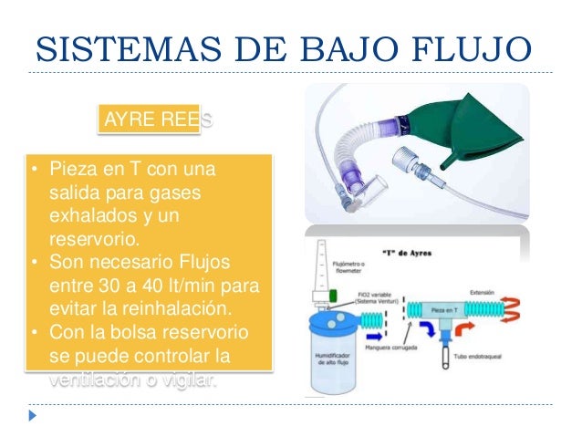 OXIGENOTERAPIA