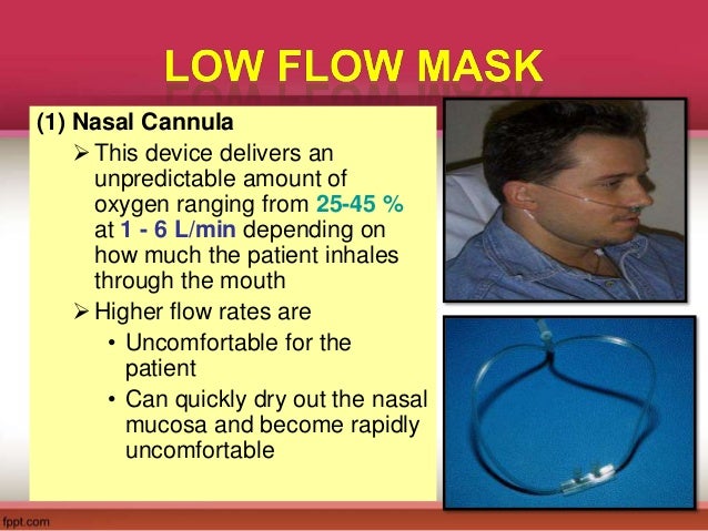 define nasal cannula