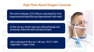 High Flow Nasal Oxygen Cannula
 