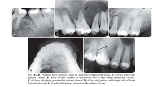 Periapical Radiopacity Classification periapical radiopacities | PPTX
