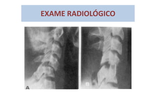 EXAME RADIOLÓGICO
 
