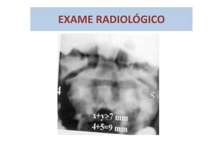 EXAME RADIOLÓGICO
 