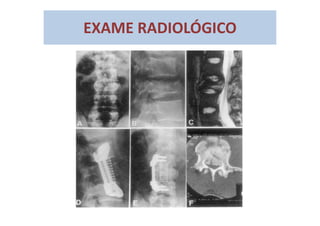 EXAME RADIOLÓGICO
 