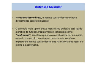 Distensão Muscular
• No traumatismo direto, o agente contundente se choca
diretamente contra o músculo.
• O exemplo mais típico, deste mecanismo de lesão está ligado
a prática do futebol. Popularmente conhecido como
“paulistinha”, acontece quando o membro inferior em apoio,
estando o músculo quadríceps contraturado, recebe o
impacto do agente contundente, que na maioria das vezes é o
joelho do adversário.
 