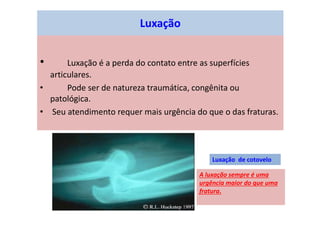 Luxação
• Luxação é a perda do contato entre as superfícies
articulares.
• Pode ser de natureza traumática, congênita ou
patológica.
• Seu atendimento requer mais urgência do que o das fraturas.
Luxação de cotovelo
A luxação sempre é uma
urgência maior do que uma
fratura.
 