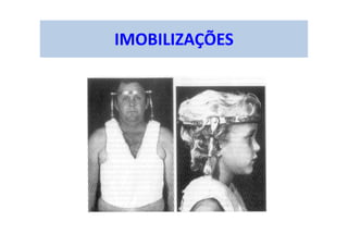 IMOBILIZAÇÕES
 