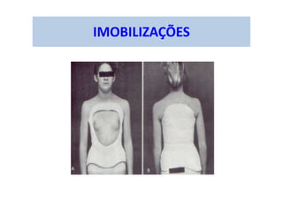IMOBILIZAÇÕES
 
