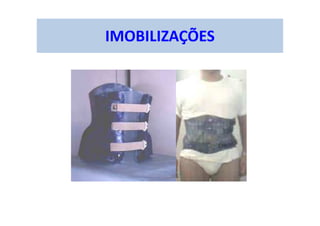 IMOBILIZAÇÕES
 