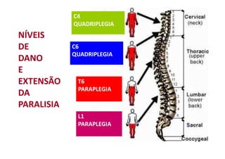 C4
QUADRIPLEGIA
C6
QUADRIPLEGIA
T6
PARAPLEGIA
L1
PARAPLEGIA
NÍVEIS
DE
DANO
E
EXTENSÃO
DA
PARALISIA
 