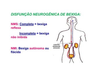 DISFUNÇÃO NEUROGÊNICA DE BEXIGA:
NMS: Completa = bexiga
reflexa
Incompleta = bexiga
não inibida
NMI: Bexiga autônoma ou
flácida
 