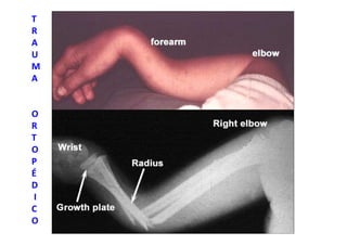 T
R
A
U
M
A
O
R
T
O
P
É
D
I
C
O
 