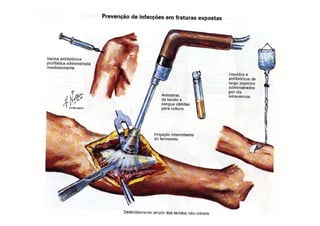 figura
10/12/2015 Dr. José Heitor M.Fernandes 33
 