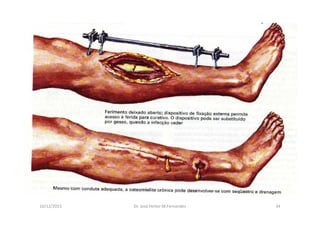 figura
10/12/2015 Dr. José Heitor M.Fernandes 34
 