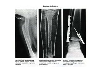 figura
10/12/2015 Dr. José Heitor M.Fernandes 36
 