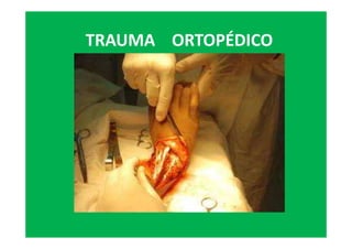 TRAUMA ORTOPÉDICO
 