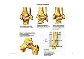 figura
10/12/2015 Dr. José Heitor M.Fernandes 54
 
