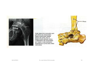 figura
10/12/2015 Dr. José Heitor M.Fernandes 55
 