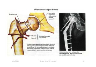 10/12/2015 Dr. José Heitor M.Fernandes 56
 