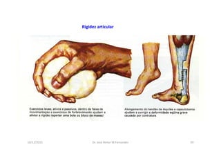 figura
10/12/2015 Dr. José Heitor M.Fernandes 59
Rigidez articular
 