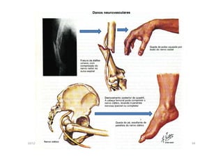 figura
10/12/2015 Dr. José Heitor M.Fernandes 64
 