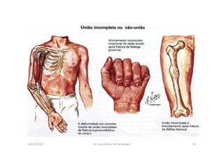 figura
10/12/2015 Dr. José Heitor M.Fernandes 67
 